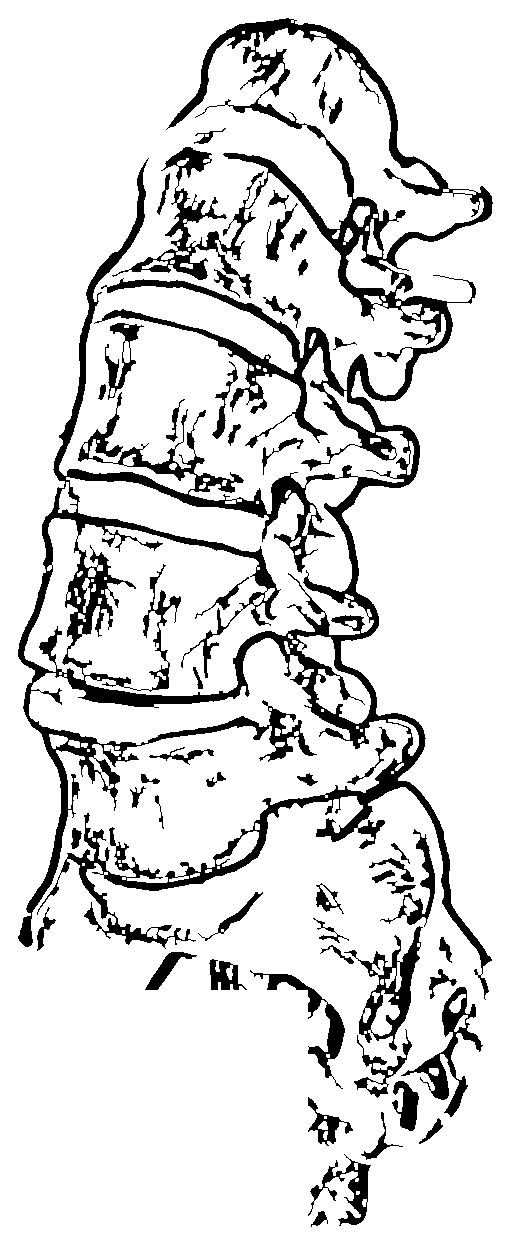 Illustration of a spine